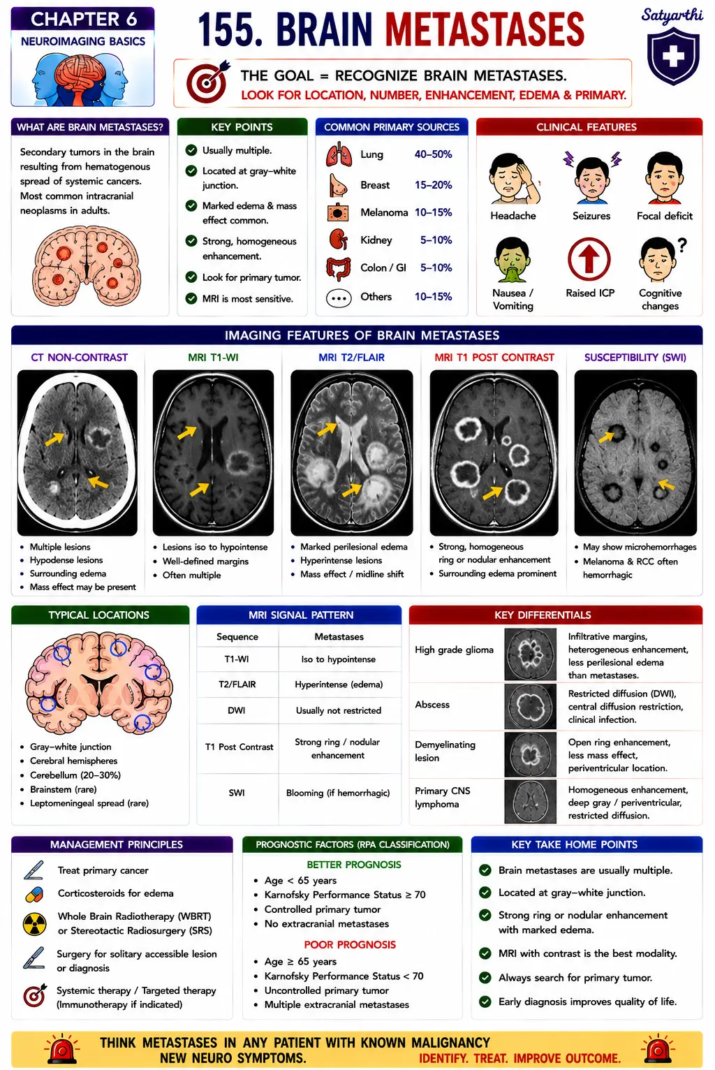 155. Brain Metastases