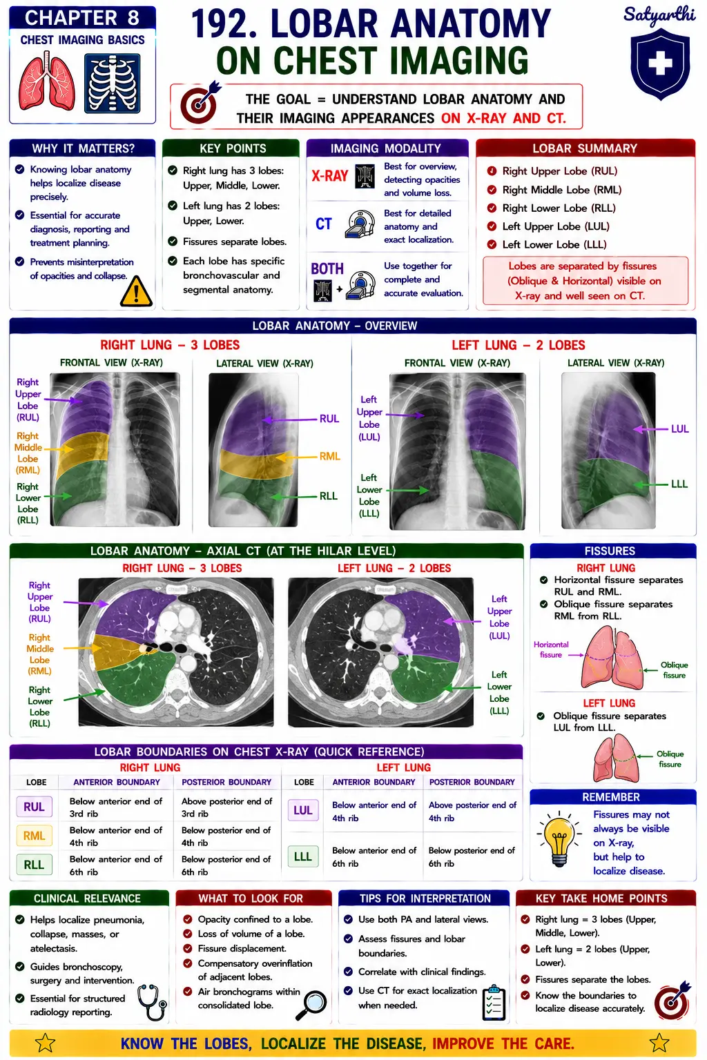 192. Lobar Anatomy on Chest Imaging